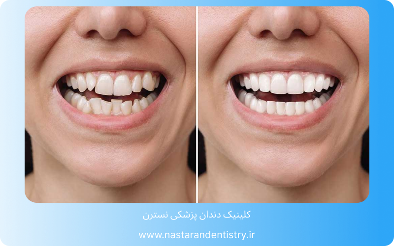 قیمت هر واحد لمینت