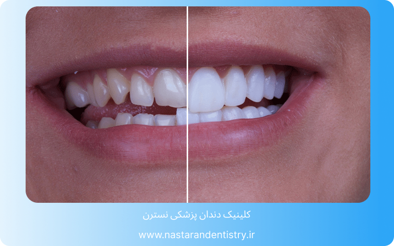 قیمت هر واحد لمینت