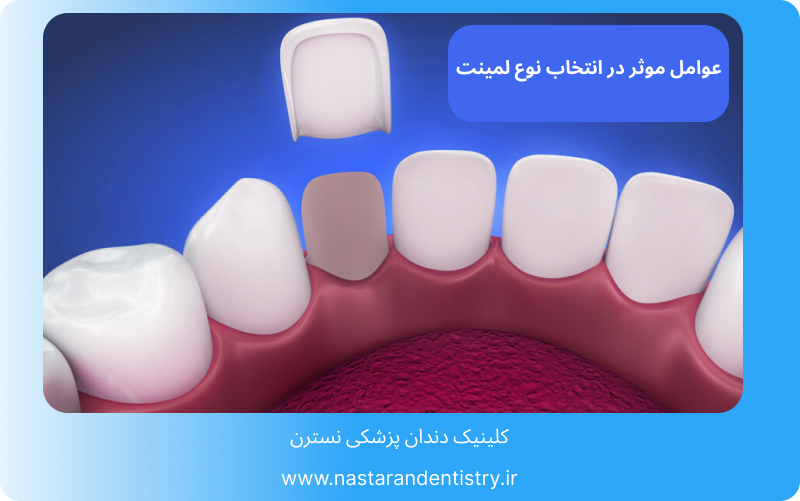 قیمت هر واحد لمینت