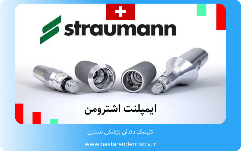 عمر ایمپلنت اشترومن