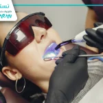 بلیچینگ دندان: رازهایی برای نتایج ماندگار