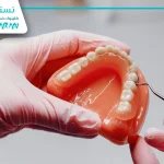 پروتز دندان پارسیل، ثابت و متحرک