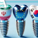 ایمپلنت ایرانی یا خارجی: بررسی فاکتورهای انتخاب