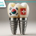 ایمپلنت کره ای یا سوئیسی: بررسی معیارهای انتخاب برند