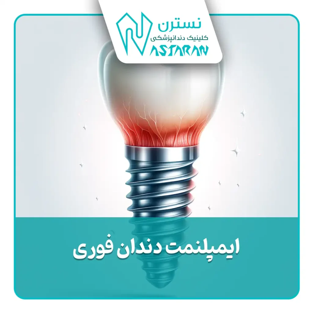 ایمپلنت دندان 24 ساعته