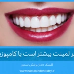 عمر لمینت بیشتر است یا کامپوزیت؟ | تفاوتهای اصلی لمینت و کامپوزیت