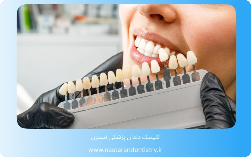 دندانپزشکی بزرگسالان لبخندی زیبا در هر سنی (4)