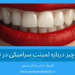 همه چیز درباره لمینت سرامیکی در تهران