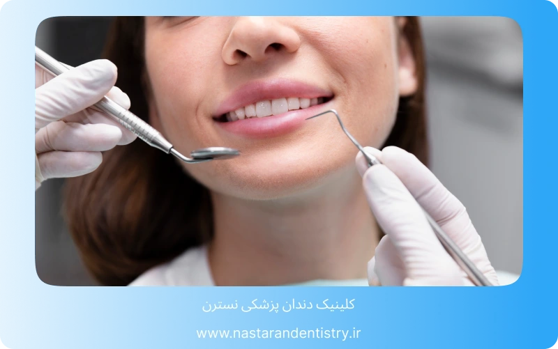 همه چیز درباره لمینت سرامیکی در تهران (4)