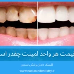 قیمت هر واحد لمینت چقدر است؟