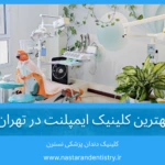 کلینیک ایمپلنت ارزان در مرکز تهران