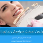 بهترین لمینت سرامیکی در تهران