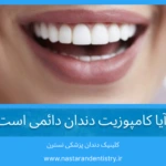 آیا کامپوزیت دندان دائمی است؟