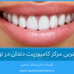 بهترین مرکز کامپوزیت دندان در تهران