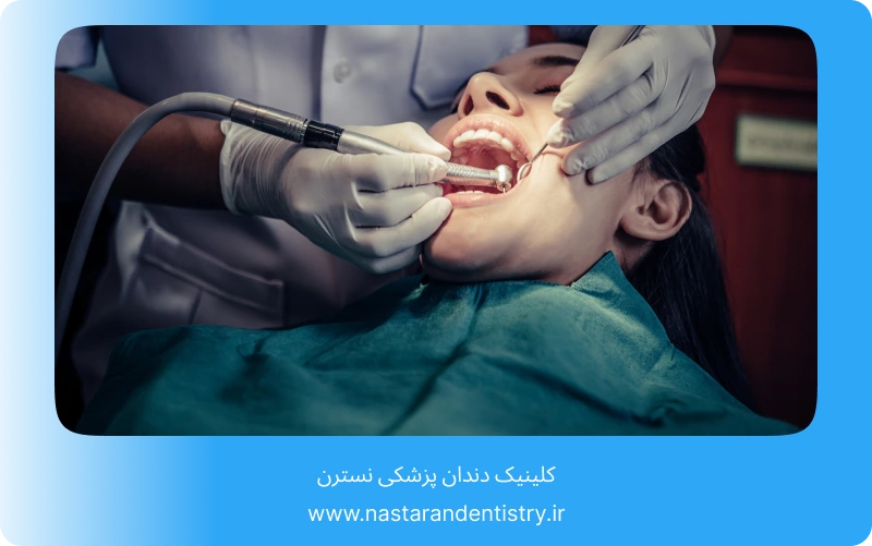 جراحی دندان عقل روی عصب بدون درد (2)