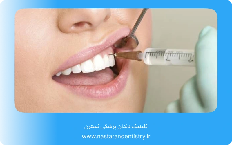 جراحی دندان عقل روی عصب بدون درد (4)