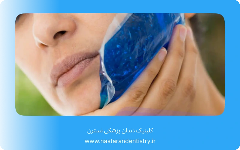 جراحی دندان نهفته جلو در تهران (5)