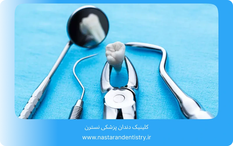 جراحی دندان نهفته جلو در تهران (6)