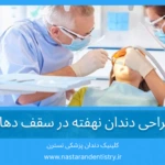 جراحی دندان نهفته در سقف دهان
