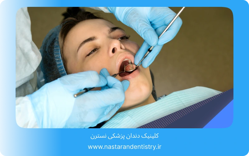 جراحی دندان نهفته در سقف دهان (2)