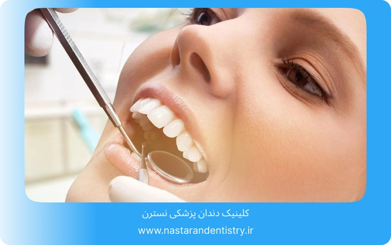 جراحی دندان نهفته در سقف دهان (3)