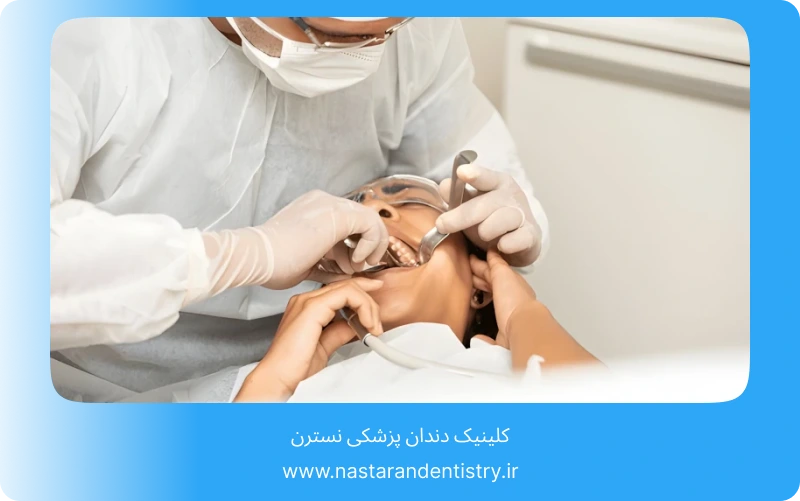 جراحی دندان نهفته در سقف دهان (5)