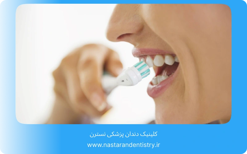 جراحی دندان نیش نهفته چقدر طول میکشد؟ (4)