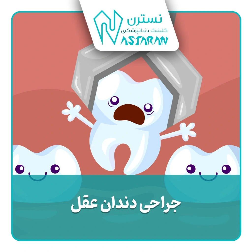 جراحی دندان عقل